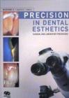 Precision in dental esthetics. Clinical and laboratory procedures