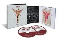 In utero 30th