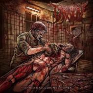 Morbid nailgun nectropsy