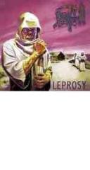 Leprosy